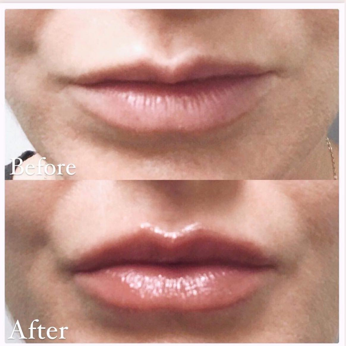 Lip Hydrator & Plumper - Lucy & CO