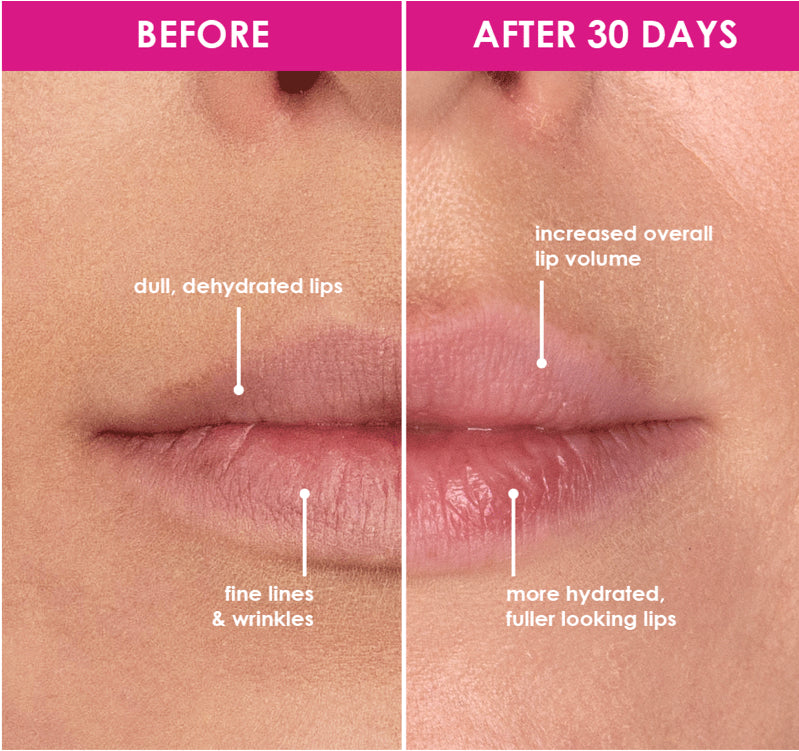 GrandeLIPS Hydrating Lip Plumper | Gloss